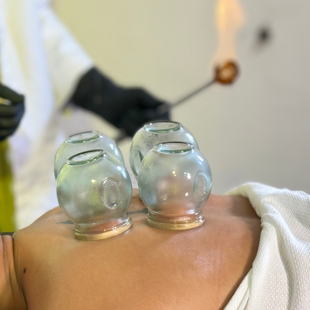 Cupping Therapy