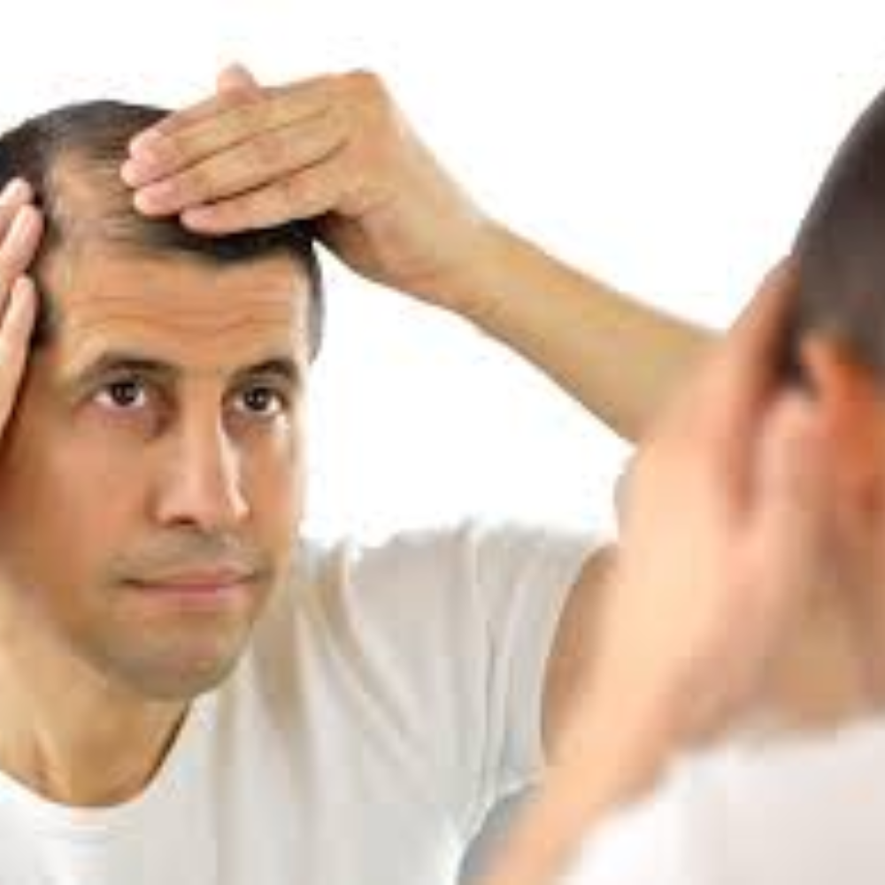 Hairfall Treatment (Male)